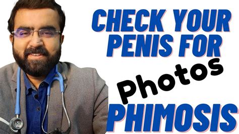 phimosis photos